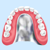 自費診療の入れ歯 